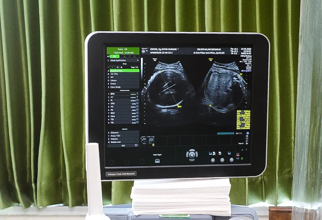 Rawat Jalan Kandungan - RSI Siti Hajar Sidoarjo